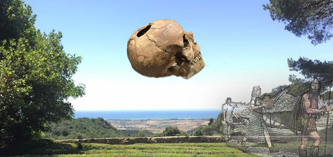 Human skull with evidence of trepanation from Grotta Patrizi, Sasso di Furbara (RM); Neolithic – Museum of Civilizations, Rome. INV. MPE 101236